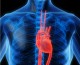 Choroby układu sercowo-naczyniowego