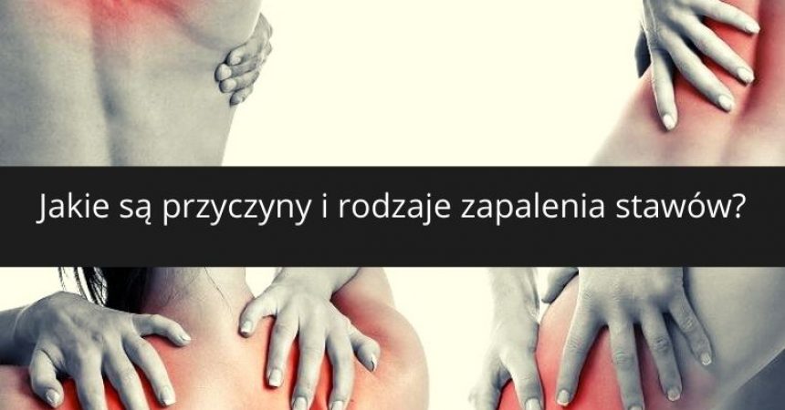 Czy mam zapalenie stawów? Czy mam zapalenie stawów?